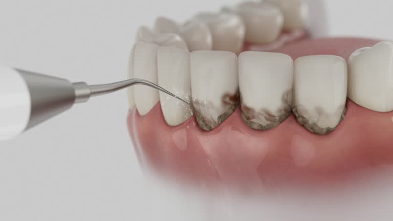 Trusted Tooth Extraction service in Waverly, IL - Dentist Open Now